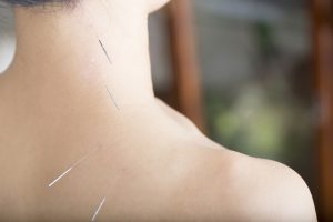 肩こり